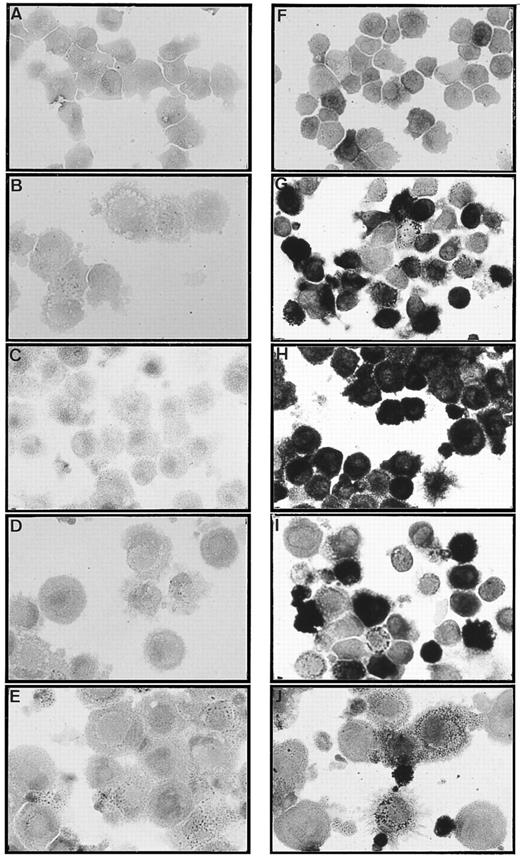 Fig. 7. Only CD14-derived DCs display nonspecific esterase activity. The CD1a- (A, B, C, D, and E) and CD14- (F, G, H, I, and J) derived DC subsets were obtained as described in Materials and Methods and in the legend to Fig 1. Cells were processed at day 6 (A and F ), day 8 (B and G), day 10 (C and H), day 13 (D and I), and day 16 (E and J) for nonspecific esterase staining. Original magnification × 400. Results are representative of three experiments.