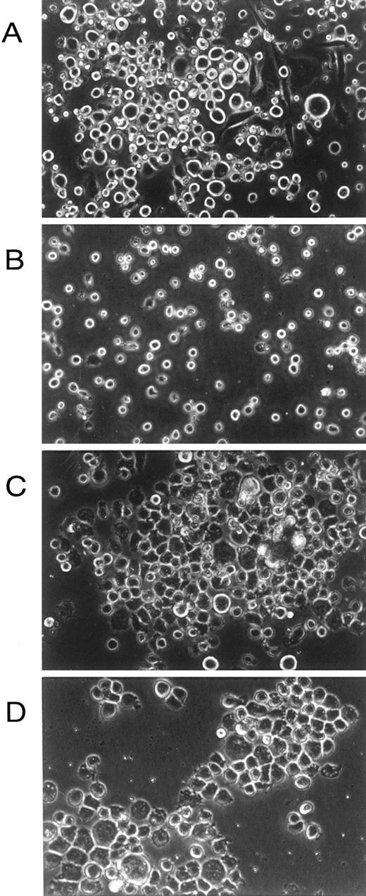Fig. 2. In situ morphology of fetal liver liquid cultures. (A) Cells infected with wild-type hβc retroviruses grown in the presence of growth factors (mIL-3, mGM-CSF, and hEpo). (B) Cells infected with V449E retroviruses grown in the absence of growth factors. (C) Cells infected with FIΔ retroviruses grown in the absence of growth factors. (D) Cells infected with I374N retroviruses grown in the absence of growth factors. Photographs are at 300× original magnification and were taken at day 14 of culture.