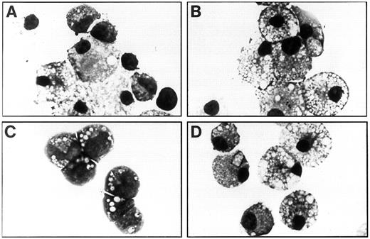 Fig. 4. Morphology of factor-dependent and -independent fetal liver cells at day 21 of liquid suspension culture. (A) Cells infected with RufNeo-hβc grown in IL-3, GM-CSF, and Epo. (B) Cells infected with RufNeo-FIΔ grown in the absence of growth factors. (C) Cells infected with RufNeo-V449E grown in the absence of growth factors. (D) Cells infected with RufNeo-I374N grown in the absence of growth factors. Photographs are at 780× original magnification.