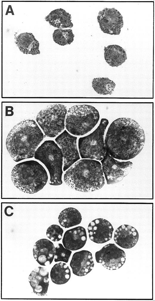 Fig. 7. Morphology of factor-independent fetal liver cell lines. (A) For comparison, mast cells obtained from fetal liver cultures infected with RufNeo-hβc and cultured for 6 weeks in the presence of growth factors (IL-3, GM-CSF, and Epo). (B and C) RTVE1 and RTVE2 cell lines, respectively, obtained after infection of fetal liver cells with RufNeo-V449E. Photographs are at 780× original magnification.