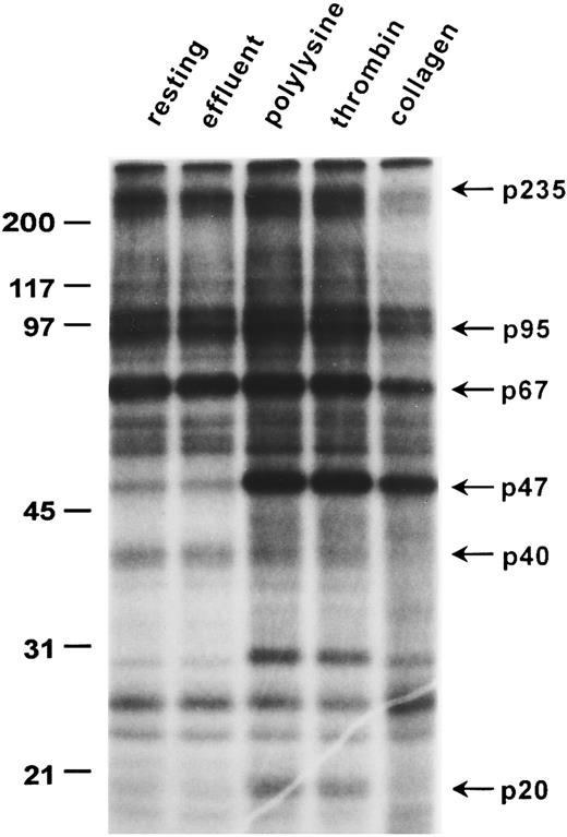 Fig. 1. Adhesion-induced dephosphorylation of a 67-kD protein band. Washed, 32P-labeled human platelets were used to assess changes in phosphorylation caused either by adhesion to collagen and polylysine or by thrombin-induced aggregation as described in the Materials and Methods. Whole cells lysates from 1.5 × 107 platelets were analyzed by 12% SDS-PAGE full-size gels: “resting” refers to control unstimulated platelets; “effluent” refers to platelets that failed to adhere to collagen; “polylysine” refers to platelets adherent to polylysine; “collagen” represents platelets adherent to collagen; and “thrombin” refers to platelets aggregated by thrombin (1 U/mL). Molecular weight standards (in kilodaltons) are shown on the left, and the weights of some protein bands altered by adhesion are indicated on the right. An autoradiogram representative of six experiments is presented.