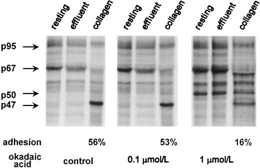 Fig. 2. Effect of phosphoprotein phosphatase inhibition by OA on dephosphorylation of the 67-kD protein band. 32P-labeled platelets (6 × 108 platelets/mL) were incubated for 10 minutes at 37°C with 0.1 and 1 μmol/L OA or with buffer for 10 minutes and then used for adhesion experiment as in Fig 1. Adhesion (as a percentage) is shown for the control and OA-treated cells. Lysates from 1.5 × 107 platelets were applied per each lane and analyzed by 8% SDS-PAGE full-size gels. Phosphorylation patterns for the 47-(pleckstrin), 50-, 67-, and 95-kD protein bands are shown on the left. An autoradiogram representative of three experiments is presented.