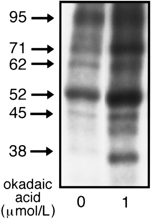 Fig. 7. Effect of OA on phosphorylation of the hsc70 complex. 32P-labeled resting platelets (5 × 108 platelets/mL) preincubated for 10 minutes at 37°C with either 1 μmol/L OA (OA-treated) or with 0.1% DMSO (control) were lysed and immunoprecipitated with anti-hsc70 MoAb. To avoid gel overexposure after OA treatment, only 25% of the total immunoprecipitated material from control and OA-treated platelets was applied to the 8% SDS-PAGE minigels, dried, and analyzed by autoradiography. One of five similar experiments is presented.