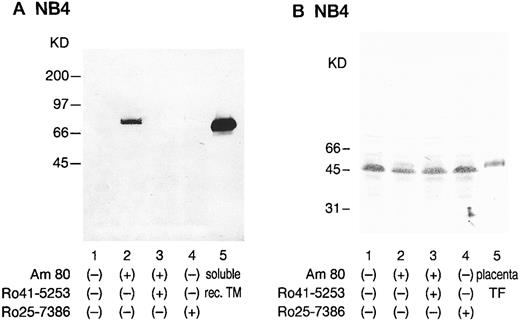 Fig. 7. Western blot analysis of NB4 cells modulated by synthetic retinoids with anti-TM and anti-TF antibodies. NB4 cell lysates (5 × 106 cells) were subjected to immunoblotting analysis using a monoclonal anti-TM antibody, KA-4 (A), and a monoclonal anti-TF antibody, 5G9 (B). Sodium dodecyl sulfate-polyacrylamide gel electrophoresis was performed under nonreducing conditions. NB4 cells were incubated with 0.01 μmol/L Am80 (lane 2) or Ro25-7386 (lane 4) for 24 hours. Selective counteractive effect of Ro41-5253 (1 μmol/L) on the effect of Am80 was also observed (lane 3). Lane 1 shows untreated NB4 cell lysate. Molecular weight markers are given along the left margin. Soluble recombinant TM (A; lane 5) and placenta TF (B; lane 5) were used as controls.