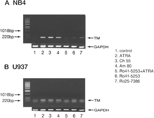 Fig. 8. RT-PCR analysis of TM mRNA in NB4 cells modulated by synthetic retinoids. Total RNA was extracted from cultured NB4 (A) or U937 cells (B) after exposure to 0.01 μmol/L of ATRA (lane 2), Ch55 (lane 3), Am80 (lane 4), or Ro25-7386 (lane 7) and 1 μmol/L of Ro41-5253 (lane 6) for 5 hours. RT-PCR analysis of mRNA was performed as described in the Materials and Methods. Selective counteractive effect of Ro41-5253 (1 μmol/L) on the effect of ATRA was also observed (lane 5). Lane 1 represents untreated control. Basepair markers are given on the left.