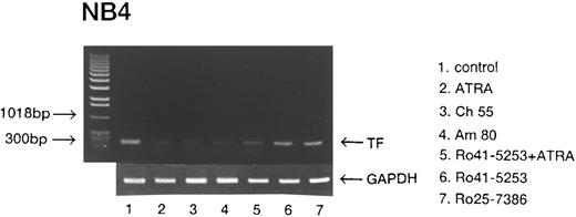 Fig. 9. RT-PCR analysis of TF mRNA in NB4 cells modulated by synthetic retinoids. NB4 cells were treated with various retinoids as depicted in Fig 8. RT-PCR analysis of TF mRNA was performed as described in the Materials and Methods.