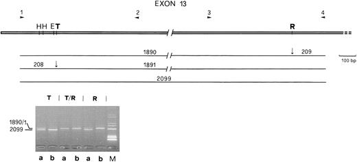 Fig. 1. (Upper part) Localization of the polymorphic sites and of primers used to define haplotypes in exon 13 of the FV gene. H, HinfI; E, EcoRI; T, Taq I; R, Rsa I. (Lower part) Single (T and R) and combined (T/R) restriction of the large fragment (2,099 bp) for the assignment of linkage between polymorphisms in a doubly heterozygous subject (a, Indian no. 5); b, homozygous subject used as control (Indian no. 33 in Table 1). The restriction map for each allele is reported above the gel. The band corresponding to the 208/9-bp fragments is not shown. M, molecular weight marker. Fragment size is given in basepairs.