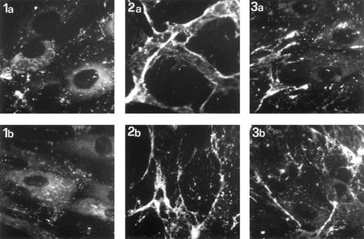 Fig. 5. Representative images of two experiments showing shear stress-induced vWF release by immunofluorescence. Confluent HUVEC were maintained in static conditions (1a and 1b), subjected to shear stress of 8 dynes/cm2 for 6 hours (2a and 2b), or stimulated with IL-1β (100 U/mL) for 6 hours (3a and 3b). After fixation and permeabilization, the cells were stained by sequential incubation with rabbit anti-vWF antibodies and fluorescein-conjugated antirabbit IgG. The rod-shaped Weibel-Palade bodies are found in unstimulated controls, whereas cells exposed to flow and stimulated with IL-1β showed a depletion of Weibel-Palade bodies and the appearance of extracellular patches of staining.