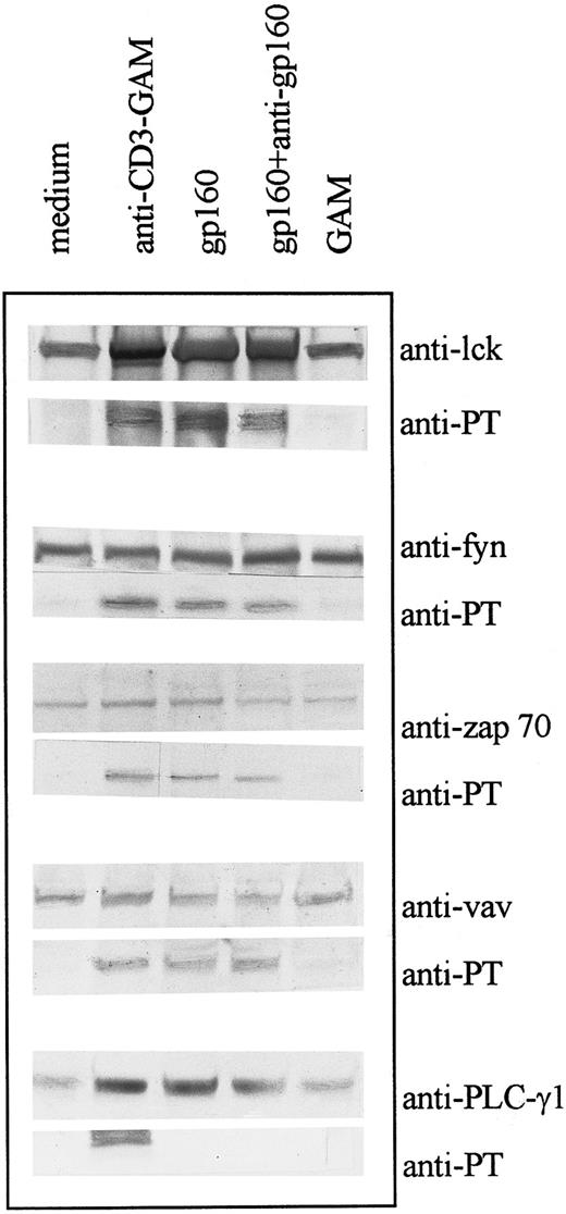 Fig. 1. CD4 ligation with gp160 or CD4XL with gp160 and anti-gp160 induces tyrosine phosphorylation of various cellular substrates: CD4+ T cells were treated with gp160 alone or with gp160 plus anti-gp160. Cell lysates were precleared and immunoprecipitated with antibodies to substrates p56lck, p59fyn, ZAP-70, PLC-γ1 (145 kD), and p95vav as indicated and immunoblotted with either the specific antibody or with antiphosphotyrosine antibody (4G10).