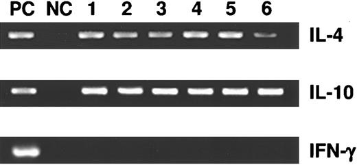Fig. 6. Detection of mRNA production by RT-PCR in cytokine-treated BALB/c mice (groups 1 to 6). At day 21 after BCL1 inoculation and cytokine treatments, splenic T cells were isolated and their RNA extracted for analysis. They were probed for the presence of IL-4, IL-10, and IFN-γ messages in RT-PCR. A plasmid containing the cDNA for all three cytokines served as the positive control (PC). Negative control (NC) lanes were without template DNA.