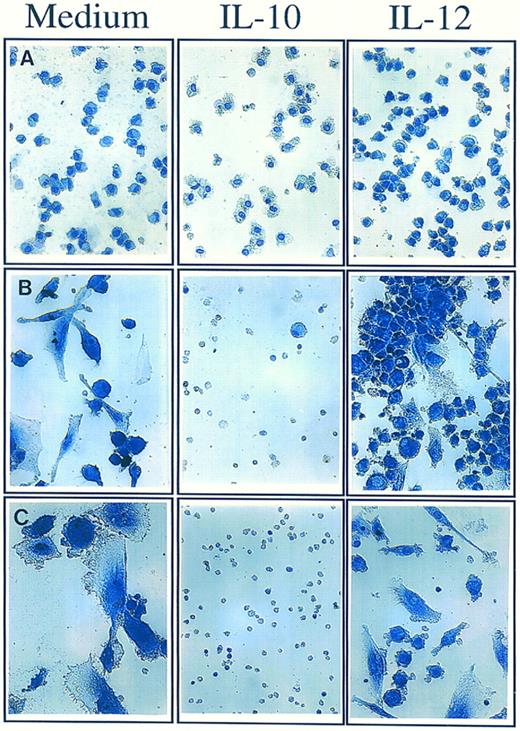 Fig. 1. Effect of IL-10 and IL-12 on long-term survival and differentiation of monocytes. Monocytes (1 × 105/mL) were cultured for 10 days in poly–L-lysine coated plates either in medium alone or in the presence of IL-10 (400 ng/mL) or IL-12 (400 ng/mL) added at the onset of the culture. Monocytes are shown after 1 day (A), 5 days (B), and 10 days (C) of culture. Monocytes were visualized using hematoxilin-eosin coloration (Original magnification × 350). These results are from one representative experiment out of three.