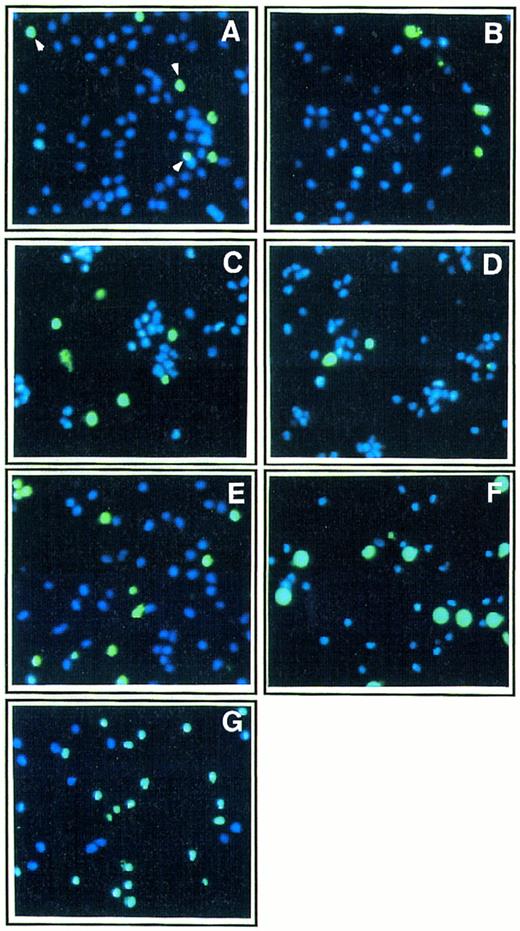 Fig. 2. Effect of Th1 and Th2 cytokines on morphologic features of apoptosis in monocyte culture. Ultraviolet fluorescence microscopic analysis of monocytes (1 × 105 cells/mL) cultured for 48 hours in poly–L-lysine coated plates in the presence of medium alone (A) or either IL-2 (200 IU/mL; B), IFN-γ (10,000 IU/mL; C), IL-12 (400 ng/mL; D), IL-4 (400 ng/mL; E), IL-10 (400 ng/mL; F ), or a mixture of IL-4 (400 ng/mL) and IL-10 (400 ng/mL; G). After the 2-day culture, cells were treated with two fluorescent nuclear dyes, YOPRO-1 (10 μmol/L, for 5 minutes), which stains apoptotic cells in green, and Hoechst 33342, which stains in blue nuclei from both living and apoptotic cells (original magnification × 250); percentages of apoptotic cells were 18% (A), 17% (B), 32% (C), 16% (D), 30% (E), 38% (F ), and 55% (G). Two hundred cells were counted in each field, and results are mean from analyses of three fields for each experimental condition. These results are from one representative experiment out of three.