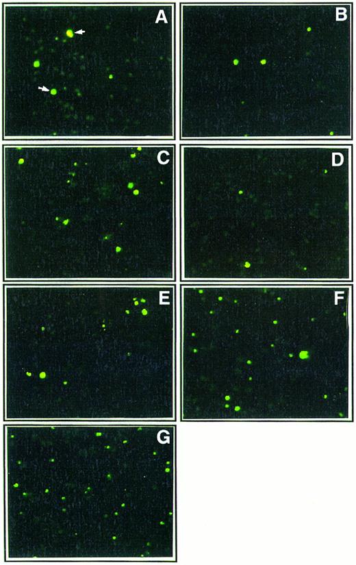 Fig. 3. Effect of Th1 and Th2 cytokines on DNA fragmentation in monocyte cultures. Ultraviolet fluorescence microscopic analysis of monocytes (1 × 105 cells/mL) cultured for 48 hours in poly–L-lysine coated plates in the presence of medium alone (A) or either IL-2 (200 IU/mL; B), IFN-γ (10,000 IU/mL; C), IL-12 (400 ng/mL; D), IL-4 (400 ng/mL; E), IL-10 (400 ng/mL; F ), or a mixture of IL-4 (400 ng/mL) and IL-10 (400 ng/mL; G). After the 2-day culture, in situ DNA fragmentation was assessed by the TUNEL method using FITC-dUTP (see Material and Methods section). Strand break DNA in apoptotic cells were visualized in green (original magnification × 250). These results are from one representative experiment out of three.