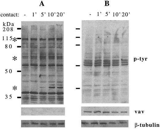 Fig. 7. Contact between normal human B-cell precursors and stromal cells increases tyrosine phosphorylation of multiple stromal cell but not B-cell precursor proteins. Stromal cells and normal human CD10+ CD19+ surface IgM− B-cell precursors were incubated at 37°C, collected, lysed, electrophoresed, and immunoblotted as detailed in the Materials and Methods. (A) Stromal cells in medium for 5 minutes (−) or in contact with B-cell precursors for the times indicated (in minutes). (B) B-cell precursors in medium alone (−) or in contact with stromal cells for the times indicated (in minutes). (Upper panel) Antiphosphotyrosine immunostaining. (Middle panel) Anti-vav immunostaining. (Lower panel) Anti–β-tubulin immunostaining. Asterisks indicate the major stromal cell protein species demonstrating consistent increases in tyrosine phosphorylation. Results are representative of two individual experiments.