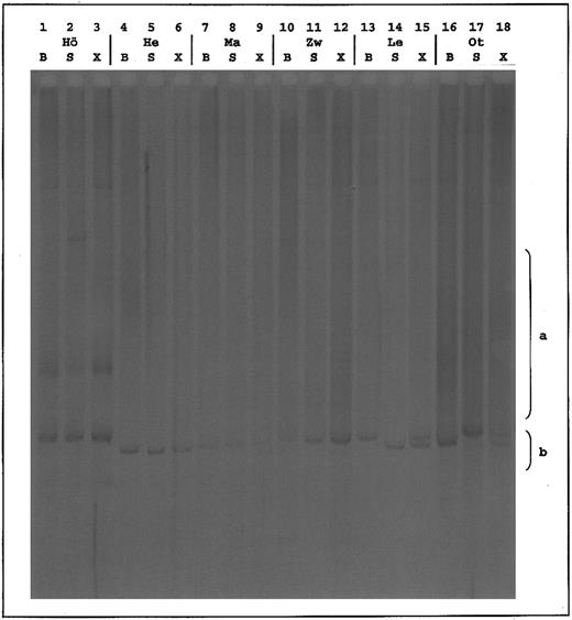 Fig. 3. Temperature gradient gel of mixed corresponding clonal TCRγ PCR products. S, skin sample; B, blood sample; X, mixture of blood and skin sample (1:1). Patients Hö, He, Ma, and Zw show identical patterns in all 3 lanes; patients Le and Ot have different patterns, whereby lane X appears as summation of B and S. a, range of polyclonal smears; b, range of clonal bands.