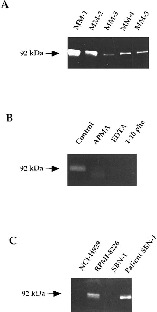 Fig. 1. Gelatinase expression in human myeloma cells. Gelatin zymography of 48-hour serum-free conditioned media was performed on equal aliquots (15 μL) as described in the Materials and Methods. (A) Lanes 1 through 3 and 5, purified myeloma cells from bone marrow of patients with MM; lane 4, purified myeloma cells from peripheral blood of a patient with PCL. (B) Supernatants of purified myeloma cells were treated for 24 hours by APMA (10 mmol/L; lane 2), EDTA (10 mmol/L; lane 3), or 1-10 Phenanthroline (1 mmol/L; lane 4) at 37°C. (C) Lanes 1 through 3, HMCL NCI-H929, RPMI-8226, and SBN-1; lane 4, primary tumor myeloma cells that engendered SBN-1.
