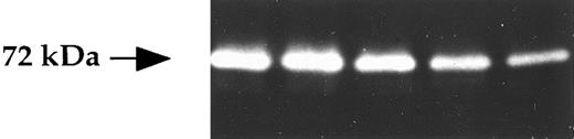 Fig. 3. Gelatinase expression in BMSC. BMSC (1.5 × 104/100 μL) were cultured for 48 hours and then the corresponding supernatants were studied by gelatin zymograghy.