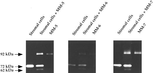 Fig. 7. Zymography analysis of coculture media. Stromal cells were seeded in 96-well plates at a concentration of 1.5 × 104 cells/100 μL/well. Myeloma cells (1.25 × 105 cells/well) were added to stromal cells, and supernatants were harvested after 48 hours of coculture. Lane 1, monoculture of BMSC; lane 2, coculture of BMSC and myeloma cells; lane 3, monoculture of myeloma cells. Three different experiments are shown.