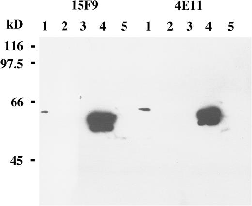Fig. 1. Western blot analysis of B-cell lines and transiently transfected Cos cells with the MoAbs 15F9 and 4E11 shows LMP2A expression in protein extracts from Cos cells transiently transfected with the LMP2A open reading frame (lanes 4). By contrast, no specific bands are detected in an EBV-negative B-cell lymphoma line, BJAB (lanes 1); an EBV-positive lymphoblastoid cell line, X50/7 (lanes 2); Cos cells transfected with the vector only (lanes 3); or Cos cells transfected with the LMP2B gene (lanes 5). A weak band is seen in BJAB cells (lane 1), probably representing cross-reactivity with a nonviral cellular protein.