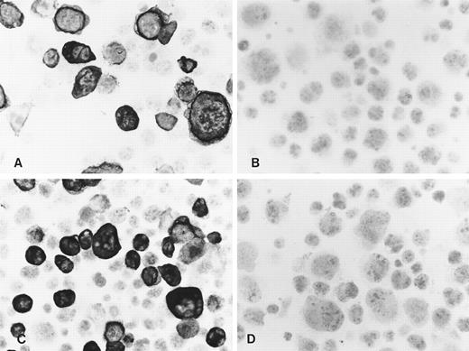 Fig. 2. Immunocytochemistry shows reactivity of the MoAbs 4E11 (A) and 15F9 (C) with a proportion of Cos cells transiently transfected with the LMP2A open reading frame. No specific staining was seen with 4E11 (B) and 15F9 (D) in vector control transfectants.