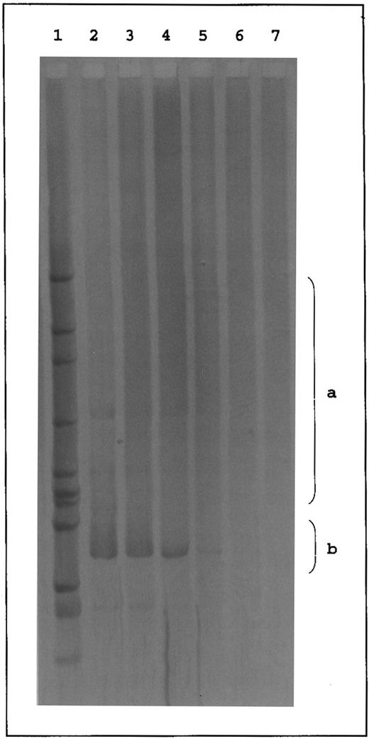 Fig. 2. Western blot analysis of RhD proteins from red blood cells of different DVI and common Rh phenotypes. Total membrane proteins from red blood cells of different DVI (DVI ccEe and DVI Ccee) and common (dccee and DccEE) Rh phenotypes were separated on sodium dodecyl sulfate-polyacrylamide gel electrophoresis (12.5%) in nonreducing conditions, transferred to a nitrocellulose membrane (0.45 mm; Schleicher & Schuell, Dassel, Germany), and immunostained with LOR-15C9 monoclonal antibody.8 Immunoblots were finally stained with antihuman IgG peroxidase-tagged antibodies (Biosys, Compiegne, France) and the peroxidase activity was shown by the ECL chemoluminescence system from Amersham (Bucks, UK).