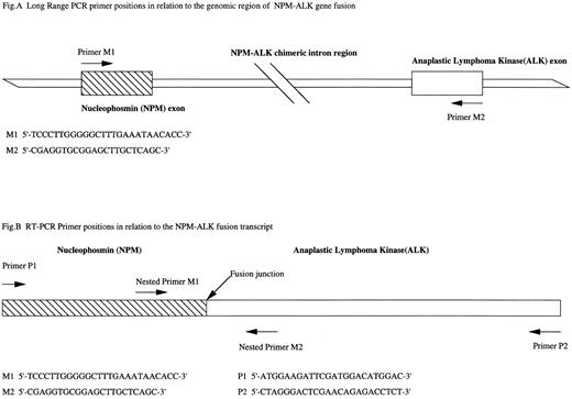 Fig. 1. (A) Long-range PCR primer sequences and their positions on the exons of nucleophosmin gene and ALK gene exons involved in the NPM-ALK gene fusion. (B) RT-PCR primer sequences in relation to the fusion transcript. Primers P1 and P2 designed by Orscheschek et al is nested by primers M1 and M2 designed by Morris et al yielding a 177-bp product.