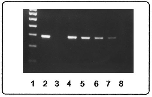 Fig. 2. Sensitivity for detection of bcr-abl–rearranged mRNA. Products from RT-PCR amplification were visualized by ethidium staining after agarose gel electrophoresis. Lane 1, 100-nt length marker; lane 2, positive control (cell line K562); lane 3, negative control (healthy donor); lanes 4 through 8, serial dilution of K562 cells (1:101, 1:102, 1:103, 1:104, and 1:105, respectively) into cells from a healthy donor. Down to 1 K562 cell diluted in 104 donor cells is easily detectable.