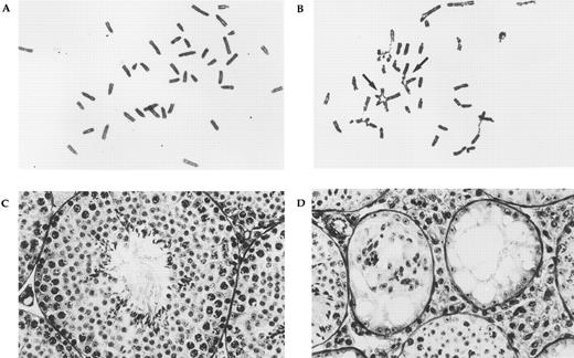 Fig. 2. Phenotypes of FAC knockout mice. Panels (A) (wild-type control) and (B) (FAC knockout mouse) show the results of chromosome breakage analysis. Cells were exposed to 20 ng/mL MMC for 48 hours. Multiple radial formation (arrows), gaps, and breaks can be seen in the mutant, but not control cells. Testicular histology of age-matched wild-type control (C) and FAC knockout mouse (D) at the same magnification. The normal control shows the cross-section of a seminiferous tubule containing all stages of spermatogenesis. In the mutant animal, two small abnormal seminiferous tubules can be seen. Spermatogenesis is absent and only Sertoli cells remain. Hypertrophy of interstitial tissue is also evident.