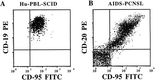 Fig. 2. Flow cytometric analysis of Fas (CD95) expression on fresh human EBV+ B-cell tumors from an hu-PBL-SCID mouse (A) and from a patient with AIDS-PCNSL (B). Tumor samples were stained with anti-Fas-FITC MoAb and either with CD19-PE or CD20-PE MoAbs, as indicated. The brain biopsy cells visualized in (B) are ungated and show that cells nonreactive for the pan-B-cell marker CD20 are also nonreactive for Fas. / (C through F) Immunoperoxidase staining for Fas expression in a representative frozen section of a human EBV+ B-cell tumor taken from a hu-PBL-SCID mouse (D), and a representative frozen section of a brain biopsy from a patient with AIDS-PCNSL (F). Sections stained with a nonreactive isotype control MoAb are shown in (C) and (E).