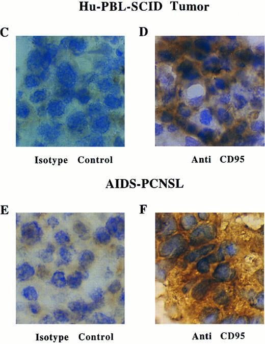 Fig. 2. Flow cytometric analysis of Fas (CD95) expression on fresh human EBV+ B-cell tumors from an hu-PBL-SCID mouse (A) and from a patient with AIDS-PCNSL (B). Tumor samples were stained with anti-Fas-FITC MoAb and either with CD19-PE or CD20-PE MoAbs, as indicated. The brain biopsy cells visualized in (B) are ungated and show that cells nonreactive for the pan-B-cell marker CD20 are also nonreactive for Fas. / (C through F) Immunoperoxidase staining for Fas expression in a representative frozen section of a human EBV+ B-cell tumor taken from a hu-PBL-SCID mouse (D), and a representative frozen section of a brain biopsy from a patient with AIDS-PCNSL (F). Sections stained with a nonreactive isotype control MoAb are shown in (C) and (E).