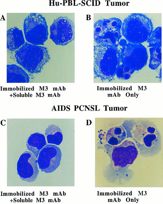 Fig. 5. Morphologic analysis of fresh human EBV+ B-cell tumors from hu-PBL-SCID mice (A and B) and from a patient with AIDS-PCNSL (C and D) in the presence of 10 μg/mL of immobilized anti-Fas M3 MoAb for 2 hours with or without a fivefold excess of soluble M3 MoAb. Morphologic characteristics of apoptosis (ie, nuclear fragmentation and membrane blebbing) are noted in (B) and (D). Wright Giemsa stain, original magnification × 330.
