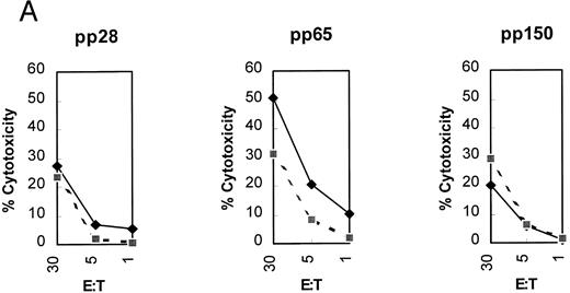 Fig. 1. (A) Initial reactivity of polyclonal CD8+ T cells to HCMV nucleoproteins. After two rounds of stimulation on HCMV-infected autologous fibroblasts, PBMCs were depleted of CD4+ T cells. The population of PBMCs before depletion was tested in a CRA for recognition against autologous (diamonds) or mismatched (squares) EBVLCL targets infected with vaccinia viruses for 16 hours expressing the HCMV proteins written above each panel. Methods for conducting the experiments can be found in Materials and Methods. Spontaneous lysis did not exceed 30% for any of the vaccinia cell lines tested. Ten thousand targets were assayed for each condition at the E:T indicated. (B) Recognition of HCMV nucleoproteins by clonal CD8+ CTL. CD4+ depleted PBMCs were cloned in 96-well plates as described in Materials and Methods. Wells were restimulated every 14 days. Colonies visible to the eye were expanded in successively larger wells, and aliquots of cells were tested against the recombinant vaccinia viruses containing HCMV proteins pp28, pp65, and pp150.11 Conditions for the CRA can be found in Materials and Methods and the legend for (a). Six representative CD8+ T-cell clones, 1G6, 3F6, 1H2, 3G2, 2H3, and 3-3F4, were tested at two different E:Ts against autologous and mismatched EBVLCL targets infected with the vaccinia viruses indicated at the bottom of the figure. Data from the E:T = 10 series are shown. / (C) Specific recognition of HCMV-infected fibroblasts by CD8+ CTL clone 3-3F4. Autologous (▨) and mismatched () fibroblasts were treated with IFN-γ for 2 days before infection with the AD169 strain of HCMV as described in Materials and Methods. Mock-infected fibroblasts were treated with medium alone. Two thousand fibroblasts were incubated with 3-3F4 T cells at an E:T of 10 in a standard 4-hour CRA. (D) MHC restriction of the 3-3F4 T-cell clone response to HCMV pp65. EBVLCL targets from individuals HLA-typed at the COH were infected with vaccinia viruses with (pp65Vac) or without (wtVac) recombinant HCMV pp65, or mock-infected. A standard CRA was performed using 10,000 targets at an E:T of 10. Cell lines expressing single allele matches from the autologous EBVLCL (A2 A28 B51 B60) were tested for recognition by the T-cell clone 3-3F4, as well as a completely matched (autologous) and mismatched EBVLCL targets. / (E) T-cell clone 3-3F4 recognizes HCMV pp65 with HLA A*0201. EBVLCL JY (▨) or Jurkat cells transfected with the HLA A*0201 genomic DNA clone (), or the untransfected parental Jurkat cells (▥) were tested for recognition by T-cell clone 3-3F4 in a standard CRA using 10,000 targets at an E:T of 10.