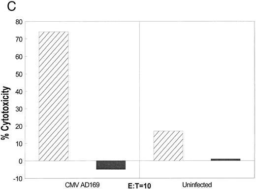 Fig. 1. (A) Initial reactivity of polyclonal CD8+ T cells to HCMV nucleoproteins. After two rounds of stimulation on HCMV-infected autologous fibroblasts, PBMCs were depleted of CD4+ T cells. The population of PBMCs before depletion was tested in a CRA for recognition against autologous (diamonds) or mismatched (squares) EBVLCL targets infected with vaccinia viruses for 16 hours expressing the HCMV proteins written above each panel. Methods for conducting the experiments can be found in Materials and Methods. Spontaneous lysis did not exceed 30% for any of the vaccinia cell lines tested. Ten thousand targets were assayed for each condition at the E:T indicated. (B) Recognition of HCMV nucleoproteins by clonal CD8+ CTL. CD4+ depleted PBMCs were cloned in 96-well plates as described in Materials and Methods. Wells were restimulated every 14 days. Colonies visible to the eye were expanded in successively larger wells, and aliquots of cells were tested against the recombinant vaccinia viruses containing HCMV proteins pp28, pp65, and pp150.11 Conditions for the CRA can be found in Materials and Methods and the legend for (a). Six representative CD8+ T-cell clones, 1G6, 3F6, 1H2, 3G2, 2H3, and 3-3F4, were tested at two different E:Ts against autologous and mismatched EBVLCL targets infected with the vaccinia viruses indicated at the bottom of the figure. Data from the E:T = 10 series are shown. / (C) Specific recognition of HCMV-infected fibroblasts by CD8+ CTL clone 3-3F4. Autologous (▨) and mismatched () fibroblasts were treated with IFN-γ for 2 days before infection with the AD169 strain of HCMV as described in Materials and Methods. Mock-infected fibroblasts were treated with medium alone. Two thousand fibroblasts were incubated with 3-3F4 T cells at an E:T of 10 in a standard 4-hour CRA. (D) MHC restriction of the 3-3F4 T-cell clone response to HCMV pp65. EBVLCL targets from individuals HLA-typed at the COH were infected with vaccinia viruses with (pp65Vac) or without (wtVac) recombinant HCMV pp65, or mock-infected. A standard CRA was performed using 10,000 targets at an E:T of 10. Cell lines expressing single allele matches from the autologous EBVLCL (A2 A28 B51 B60) were tested for recognition by the T-cell clone 3-3F4, as well as a completely matched (autologous) and mismatched EBVLCL targets. / (E) T-cell clone 3-3F4 recognizes HCMV pp65 with HLA A*0201. EBVLCL JY (▨) or Jurkat cells transfected with the HLA A*0201 genomic DNA clone (), or the untransfected parental Jurkat cells (▥) were tested for recognition by T-cell clone 3-3F4 in a standard CRA using 10,000 targets at an E:T of 10.