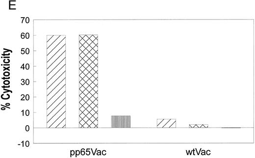 Fig. 1. (A) Initial reactivity of polyclonal CD8+ T cells to HCMV nucleoproteins. After two rounds of stimulation on HCMV-infected autologous fibroblasts, PBMCs were depleted of CD4+ T cells. The population of PBMCs before depletion was tested in a CRA for recognition against autologous (diamonds) or mismatched (squares) EBVLCL targets infected with vaccinia viruses for 16 hours expressing the HCMV proteins written above each panel. Methods for conducting the experiments can be found in Materials and Methods. Spontaneous lysis did not exceed 30% for any of the vaccinia cell lines tested. Ten thousand targets were assayed for each condition at the E:T indicated. (B) Recognition of HCMV nucleoproteins by clonal CD8+ CTL. CD4+ depleted PBMCs were cloned in 96-well plates as described in Materials and Methods. Wells were restimulated every 14 days. Colonies visible to the eye were expanded in successively larger wells, and aliquots of cells were tested against the recombinant vaccinia viruses containing HCMV proteins pp28, pp65, and pp150.11 Conditions for the CRA can be found in Materials and Methods and the legend for (a). Six representative CD8+ T-cell clones, 1G6, 3F6, 1H2, 3G2, 2H3, and 3-3F4, were tested at two different E:Ts against autologous and mismatched EBVLCL targets infected with the vaccinia viruses indicated at the bottom of the figure. Data from the E:T = 10 series are shown. / (C) Specific recognition of HCMV-infected fibroblasts by CD8+ CTL clone 3-3F4. Autologous (▨) and mismatched () fibroblasts were treated with IFN-γ for 2 days before infection with the AD169 strain of HCMV as described in Materials and Methods. Mock-infected fibroblasts were treated with medium alone. Two thousand fibroblasts were incubated with 3-3F4 T cells at an E:T of 10 in a standard 4-hour CRA. (D) MHC restriction of the 3-3F4 T-cell clone response to HCMV pp65. EBVLCL targets from individuals HLA-typed at the COH were infected with vaccinia viruses with (pp65Vac) or without (wtVac) recombinant HCMV pp65, or mock-infected. A standard CRA was performed using 10,000 targets at an E:T of 10. Cell lines expressing single allele matches from the autologous EBVLCL (A2 A28 B51 B60) were tested for recognition by the T-cell clone 3-3F4, as well as a completely matched (autologous) and mismatched EBVLCL targets. / (E) T-cell clone 3-3F4 recognizes HCMV pp65 with HLA A*0201. EBVLCL JY (▨) or Jurkat cells transfected with the HLA A*0201 genomic DNA clone (), or the untransfected parental Jurkat cells (▥) were tested for recognition by T-cell clone 3-3F4 in a standard CRA using 10,000 targets at an E:T of 10.