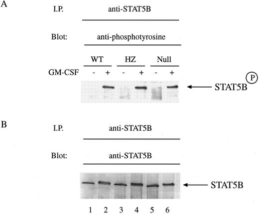Fig. 4. GM-CSF–induced tyrosine phosphorylation of STAT5B in BM-derived macrophages from WT, HZ, and STAT5A null mice. (A) BM-derived macrophages from WT (lanes 1 and 2), HZ (lanes 3 and 4), and null (lanes 5 and 6) mice were incubated with either medium (lanes 1, 3, and 5) or 10 ng/mL of GM-CSF (lanes 2, 4, and 6) for 15 minutes at 37°C and then solubilized in a buffer containing 1% Triton X-100. STAT5B was immunoprecipitated from the lysates with anti-STAT5B, and the immunoprecipitates were analyzed by SDS-PAGE followed by immunoblotting as described in Materials and Methods. The membrane was probed with the antiphosphotyrosine MoAbs PY20 and 4G10, and developed by enhanced chemiluminescence. STAT5BP denotes tyrosine phosphorylated STAT5B. (B) The amount of protein loaded within each lane of the gel was determined by reprobing the immunoblot with the immunoprecipitating anti-STAT5B antibody and developing the blot with nitroblue tetrazolium chemistry.