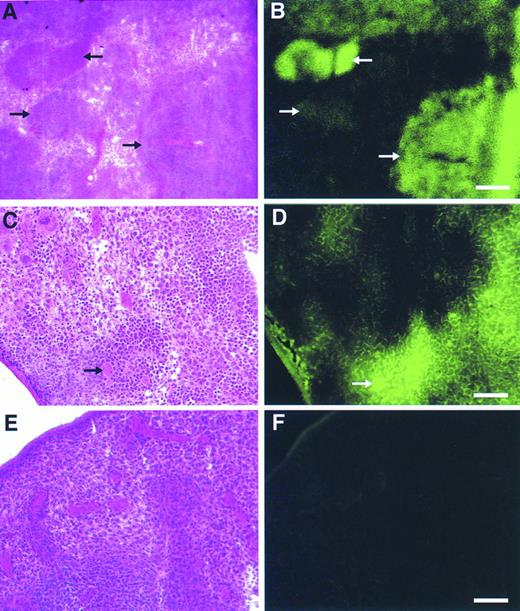 Fig. 6. Detection of gene transfer into day 12 spleen colony-forming cells using the GFP marker. Alternate, serial fresh frozen sections of spleens from animals transplanted with the GFP vector (A through D) or a control, CD24 vector (E and F) were stained with hematoxylin-eosin (A, C, and E) or directly visualized by fluorescence microscopy (B, D, and F) as described in Materials and Methods. In (A) and (B) the different arrows mark spleen hematopoietic colonies demonstrating a range of fluorescence intensities. In (C) and (D), the bold arrow denotes a GFP-marked megakaryocyte. Scale bars in (A) and (B) are equal to 325 μm, in (C) through (F) they are equal to 165 μm.