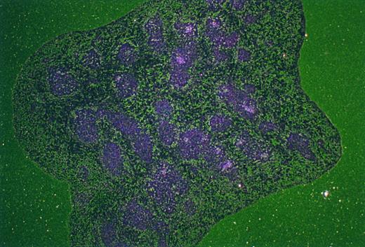 Fig. 4. In situ hybridization analysis of Mll expression in spleen. RNA in situ hybridization was performed on cryostat sections of paraformaldehyde-fixed spleen as described in Materials and Methods. High level Mll expression is confined to the splenic white pulp (original magnification × 21).