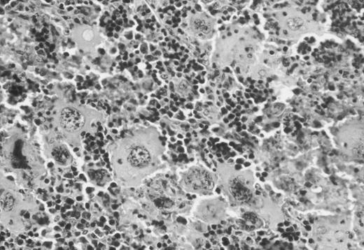 Fig. 4. Hematoxylin-eosin–stained representative histologic section of the spleen of a 12-week-old NF-E2-null male mouse showing the dramatic increase in the number of megakaryocytes.