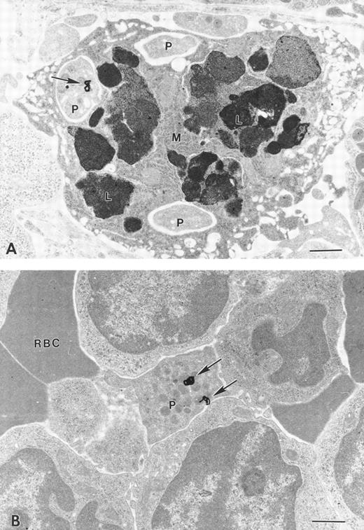 Fig. 6. Cellular localization of 125I-rTpo within the spleen of NF-E2-null and control mice analyzed by electron microscopic autoradiography. Silver grains (arrows) associated with (A) megakaryocyte fragments/platelet-like structures (P) found within or in close contact with macrophages (M) in NF-E2−/− mice and (B) with a mature platelet (P) from a control mouse. Bar, 2 μm.