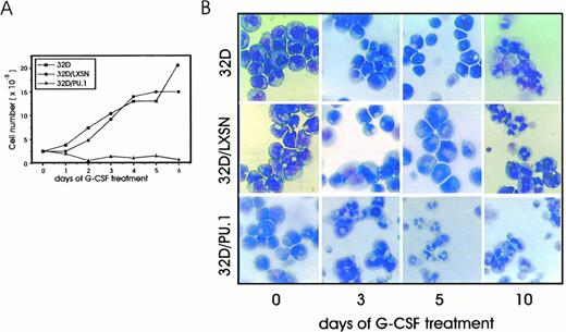 Fig. 4. (A) Growth kinetics of parental and retrovirus-infected 32D cells in G-CSF–supplemented culture medium. Cells were seeded at 2.5 × 105 cells/mL; viable cells were determined by trypan blue dye exclusion test. (B) Morphology of parental, 32D/LXSN, and 32D/PU.1 cells in the presence of IL-3 or after 3, 5, and 10 days of stimulation with G-CSF. Cells were removed from the cultures, cytocentrifuged onto slides, air-dried, and stained with May-Grünwald-Giemsa.