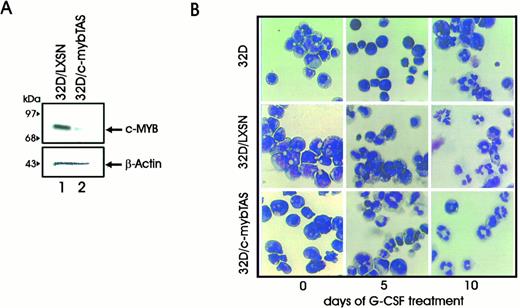Fig. 6. (A) Western blot analysis of c-myb levels in 32D cells carrying a c-myb construct in the antisense orientation. (B) G-CSF–induced differentiation of 32Dcl3 cells carrying a c-myb antisense construct (32D/myb TAS cells). Photomicrographs of 32Dcl3, 32D/LXSN, and 32D/mybTAS cells in the presence of IL-3 or after 5 and 10 days of stimulation with G-CSF. Representative microphotographs of May-Grünwald-Giemsa–stained cytospin smears are shown.