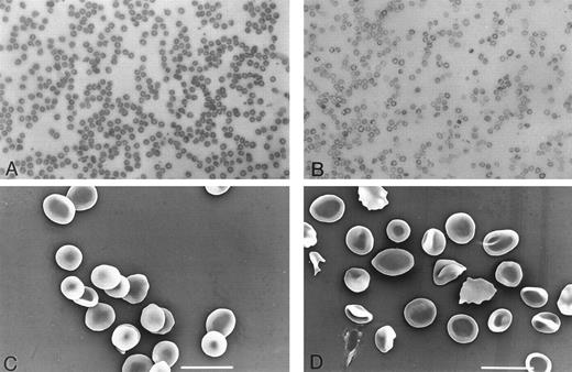 Fig. 3. Morphology of RBCs from fit1 mutant mice. Peripheral blood smear from a cch +/cch + wild-type littermate (A) and from a c fit14397SB/c26DVT mutant (B). RBCs from fit1 mutants were typically hypochromic and varied greatly in size. Scanning electron micrographs of wild-type (cch +/cch +) blood (C) and mutant (c fit14397SB/c fit14397SB ) blood (D) more clearly show the size and shape variations of the fit1 mutant RBCs. The SEM bar represents 10 mm.
