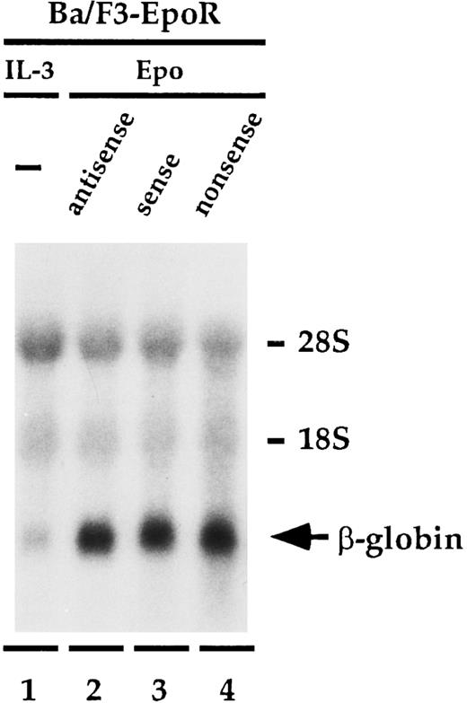 Fig. 3. Effect of oligonucleotides to β mRNA on β-globin mRNA levels. Ba/F3-EpoR cells were cultured in IL-3 (lane 1) or with 20 mmol/L antisense (lane 2), sense (lane 3), or nonsense (lane 4) in the presence of Epo, and β-globin message levels were determined by northern blot analysis. The increased levels of β-globin mRNA induced by Epo were identical in each of the samples containing oligodeoxynucleotides.