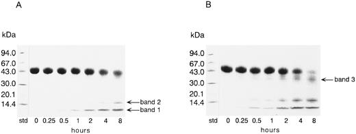 Fig. 1. SDS-PAGE analysis of rTFPI incubated with thrombin. rTFPI was incubated with thrombin in TBS at 37°C with the final concentrations of 2.6 mg/mL and 0.05 mg/mL, respectively. SDS-PAGE of the digest was performed as described in Materials and Methods. (A), Nonreducing condition; (B), reducing condition. See text for nomenclature of band 1, band 2, and band 3.