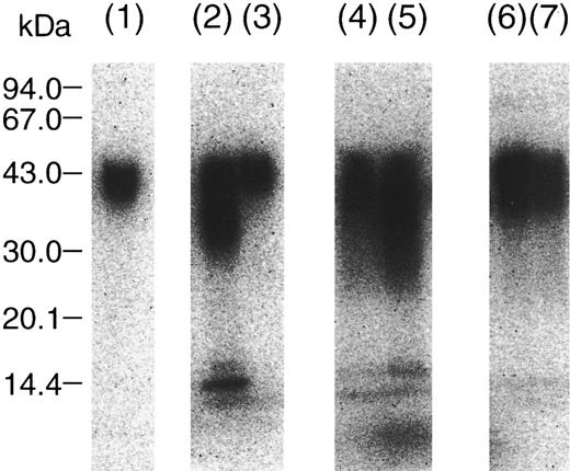Fig. 4. Degradation of 125I-TFPI in serum and fibrin clot from normal or AT-depleted plasma. Radiolabeled rTFPI was mixed with plasma, and coagulation was induced by the addition of tissue factor and Ca2+, as described in Materials and Methods. After 20 hours, the serum and fibrin clot were separated and subjected to autoradiographic analysis. (Lane 1), intact rTFPI; (lane 2), rTFPI treated with thrombin; (lane 3), rTFPI incubated with normal plasma; (lane 4), rTFPI in serum from normal plasma; (lane 5), rTFPI in serum from AT-depleted plasma; (lane 6), rTFPI in fibrin clot from normal plasma; (lane 7), rTFPI in fibrin clot from AT-depleted plasma.