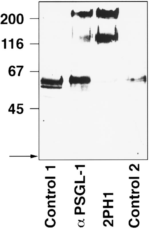 Fig. 2. PSGL-1 can be immunoprecipitated from WEHI-3B cells with anti–PSGL-1 MoAb 2PH1. WEHI-3B cells were surface-biotinylated and subjected to immunoprecipitations with IgG from a rabbit nonimmune serum (control 1), affinity-purified antibodies from a rabbit antiserum against mouse PSGL-1 (α-PSGL-1), MoAb 2PH1 (2PH1), and an isotype-matched control rat antibody (control 2). Proteins were electrophoresed on an 8% polyacrylamide gel under reducing conditions. The front of the gel is marked by an arrow on the left, and molecular mass markers (in kD) are also indicated on the left.