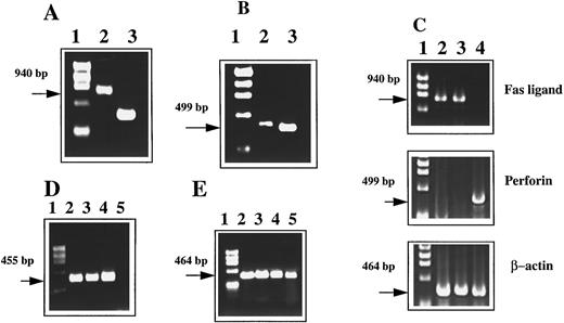 Fig. 1. Detection of Fas, FasL, and perforin mRNA using RT-PCR. PE-9 cells were stimulated with immobilized anti-CD3 MoAbs before PCR analysis. (A) PE-9 cells analyzed for FasL expression: lane 1, a molecular marker; lane 2, FasL; lane 3, β-actin (as a control). (B) PE-9 cells analyzed for perforin expression: lane 1, a molecular marker; lane 2, perforin; lane 3, β-actin. (C) FasL and perforin expression by tumor cell lines: lane 1, a molecular marker; lane 2, LSA tumor; lane 3, EL-4; lane 4, AutoD1.4T tumor. (D) Expression of Fas: lane 1, a molecular marker; lane 2, PE-9 cells; lane 3, LSA; lane 4, C57BL/6 thymocytes; lane 5, L1210 Fas− cell line. (E) β-Actin controls for Fig 1D (lanes identical to those depicted in D).
