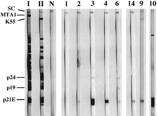 Fig. 1. Reactivity of sera from CD3-LGL patients to HTLV-I proteins. Sera were tested against HTLV blot 2.3 (Genelabs Diagnostics, Redwood City, CA) containing multiple HTLV recombinant env proteins. Assays were run in accordance with manufacturer's instructions, except that all sera were incubated with the strips overnight. The strips marked I, II, and N were incubated with sera from an HTLV-I, HTLV-II, and an uninfected individual, respectively. Strips marked 1 through 6, 9, 10, and 14 were incubated with sera from individuals with CD3− LDGL. The same numbers are used to identify individual sera in the other figures and Table 1. The migration of the viral proteins p19 and p24 as well as the positions of the recombinant proteins p21e, K55 (HTLV-II gp46), and MTA1 (HTLV-I gp46) are indicated at left. SC indicates position of the serum control band, which is reactive when human antibodies are present in the tested sample.