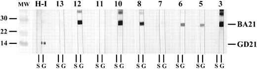 Fig. 2. Seroreactivity to purified GD21-1 and BA21 recombinant proteins. Representative Western blots displaying the reactivity of nine CD3− LGL patients (strips labeled 3, 5 through 8, 10 through 13) to HTLV-I gp21 recombinant proteins. All purified proteins were blotted at a concentration of 2 μg/cm nitrocellulose and sera were diluted and incubated as described.12 Strips containing BA21 (molecular weight ∼ 30 kD) coelectrophoresed with GD21-1 (molecular weight ∼ 15 kD) are indicated by the letter G at the bottom. Strips containing nonrecombinant sj26 are indicated by the letter S. The migration of BA21 and GD21-1 are indicated at right. Nonrecombinant sj26 has a molecular weight of 26.5. The strips labeled H-I were incubated with sera from an HTLV-I infected individual. The lanes marked MW are molecular weight standards whose size (in kD) are indicated at left.