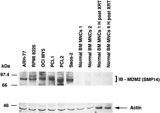 Fig. 1. Expression of MDM2 protein in MM-derived cell lines. PCL patients cells, Saos-2 osteosarcoma cells, and normal BM MNCs. Total cell lysates of MM cell lines (ARH-77, RPMI 8226, and OCI-My5), cells from PCL patients (PCL1 and PCL2), Saos-2 p53-deficient osteosarcoma cells, and normal BM MNCs (without and 1 and 4 hours post-XRT) were immunoprecipitated with SMP14 anti-MDM2 MoAb followed by immunoblotting with the same Ab. Immunoprecipitation and immunoblotting with AB-1 anti-actin MoAb confirmed equal protein loading.